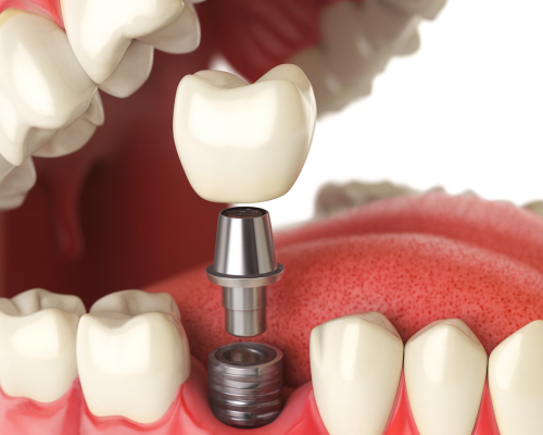 BCO.2f4df307-9a88-44e4-a9a7-7533e8035b11