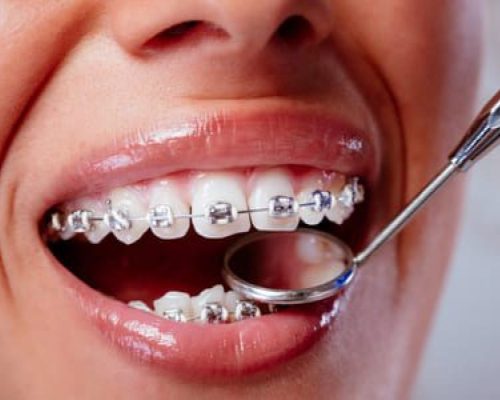 istock-849402626-1170x600-1-1-1-1250x700